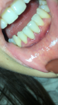 Шатаются зубы, воспаление Десны фото 1