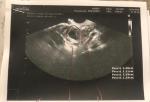 Результат УЗИ яичников фото 1