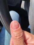 Повреждение ногтя после аппаратного маникюра фото 2