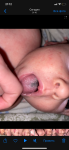 У грудного ребёнка на языке белый налёт с серыми пятнами фото 1