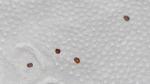 Черно коричневые зёрнышки в кале у ребёнка фото 3