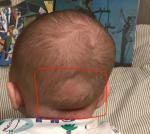 Деформация черепа головы ребенка фото 1