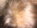 Жёлтые корочки на голове с рождения фото 2