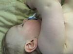 Высыпание на щёчках у ребёнка фото 1
