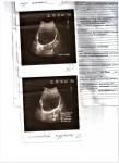Результаты УЗИ брюшной полости, почек и мочевого пузыря фото 4