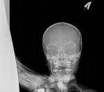 Рентген головы ребенка фото 2