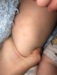 Шершавое пятно на ноге у ребёнка фото 1