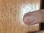 Красные пятна на ногте фото 4