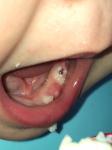 Кровь на зубе у ребенка фото 2