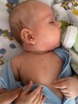 Высыпание на щечках у ребенка в 4 месяца фото 2