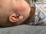 Красные шершавые пятна на лице у ребёнка фото 2