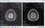 Помогите описать МРТ головного мозга фото 4