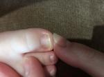 Ногти и кожа за ушком у ребенка фото 4