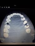 Правильно ли вылечен зуб фото 2