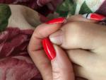 Прямая коричневая полоса на ногте у ребенка фото 1