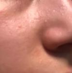 Раздражение или аллергия кожи лица фото 3
