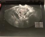 Результат УЗИ яичников фото 2