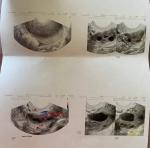 Киста анализы перед зачатием фото 2