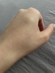 Шишка на кисти руки, болезненность при нажатии фото 2