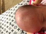 Мелкая сыпь на теле у новорожденного фото 2