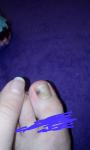 Темное пятно на ногте у ребенка фото 1