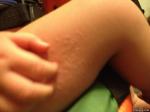 Сыпь у ребенка по всему телу фото 2
