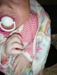 Акне новорожденных или аллергия фото 3