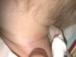Появились какие-то два Пятна на шее у ребёнка 12 месяцев фото 1