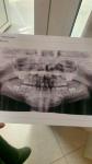 Зубная боль у ребёнка фото 1