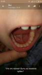 Что это на нижних зубках? фото 1