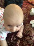Ассиметричная черепа у ребёнка в 5 месяцев фото 3