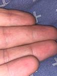 Маленькая красная точка на пальце руки со тонким стержнем фото 1