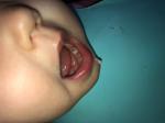 Кровь на зубе у ребенка фото 1