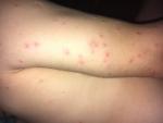 Помогите с вопросом алерргии фото 2