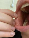 Проблемы слизистой рта фото 2