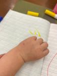 Болячка сухая на руке у малыша фото 2