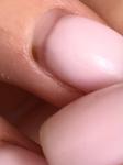 Коричневые высыпания в лунках ногтей после маникюра фото 2