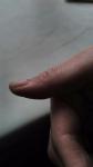 Вдавленность и трещины у основания ногтя фото 4