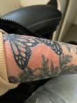 Аллергия или потница на татуировке фото 1