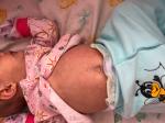 Мелкая сыпь на теле у новорожденного фото 1