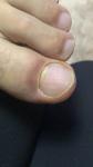 Изменение основания ногтя, пропала кутикула, рефление на ногтях фото 5