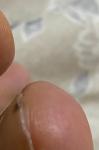 Пятно на ногтевой пластине ноги фото 3