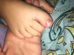 Ребёнок прищемил большой палец ноги фото 4