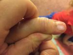 Трещины на ногтях больших пальцев фото 5