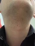 Неравномерно растут волосы на бороде фото 1