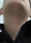 Неравномерно растут волосы на бороде фото 2