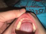 Зуб растет криво у ребенка фото 1