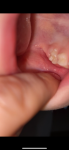 Аномальный молочный зуб? фото 1