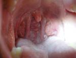Ощущение кома в горле периодически болит горло фото 1