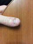 Палец руки фото 1